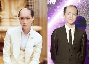 假发男吃瓜,揭秘娱乐圈幕后趣闻